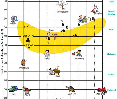 Hearing Level Chart